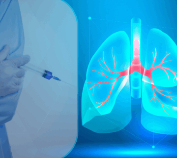 دواء-حديث-لمرضى-سرطان-الرئة-إيمريليس